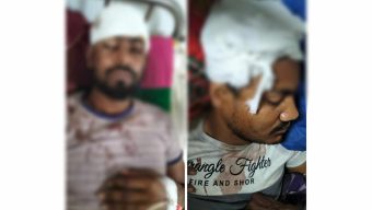 চরফ্যাশনের দুলারহাট থানা এলাকায় পূর্ব শত্রুতার জের, বাবা ও ছেলে সহ আহত ৪