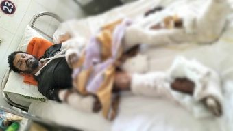 পাথরঘাটায় দিনমজুর জাকিরকে কুপিয়ে জখম, চক্ষু উৎপাটনের চেষ্টার অভিযোগ 