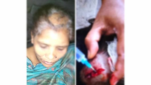 বাউফলে ছোট ভাইয়ের স্ত্রীকে কুপিয়েছে বড় ভাই ও তার সহযোগীরা 