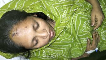 দশমিনায় সীমানা দেয়াকে কেন্দ্র করে নারীকে কুপিয়ে জখমের অভিযোগ 