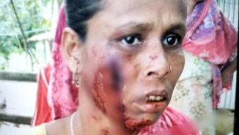 বাকেরগঞ্জের দুধলে তুচ্ছ ঘটনায় এক নারীকে পিটিয়ে রক্তাক্তের অভিযোগ