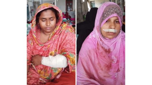 বরিশাল বিমানবন্দর থানাধীন কলস গ্রামে জমি নিয়ে সংঘর্ষে রক্তাক্ত, আহত- ৫