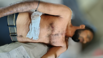 মঠবাড়িয়ায় জমি নিয়ে সংঘর্ষে পরিবারের ৩ জনকে কুপিয়ে হত্যা চেষ্টা অভিযোগ