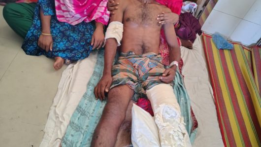 বাউফলে জামিনে বের হয়ে সাক্ষীকে হাত-পা ভেঙ্গে দেয়ার অভিযোগ