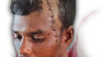 হিজলায় পূর্ব শত্রুতার জেরে শ্রমিককে কুপিয়ে হত্যা চেষ্টার অভিযোগ 