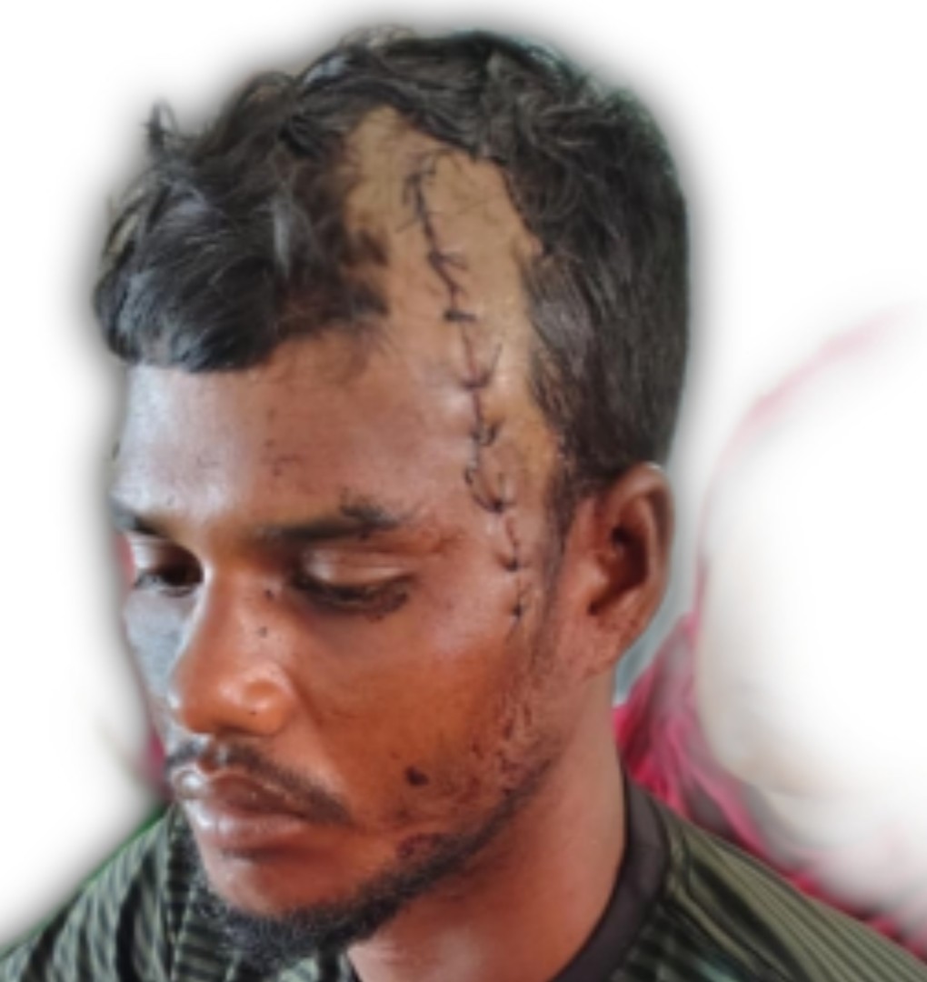 হিজলায় পূর্ব শত্রুতার জেরে শ্রমিককে কুপিয়ে হত্যা চেষ্টার অভিযোগ 