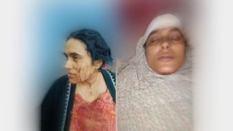 বাকেরগঞ্জের দুধলে জমি নিয়ে সংঘর্ষে গৃহবধূকে কুপিয়ে হত্যা চেষ্টার অভিযোগ