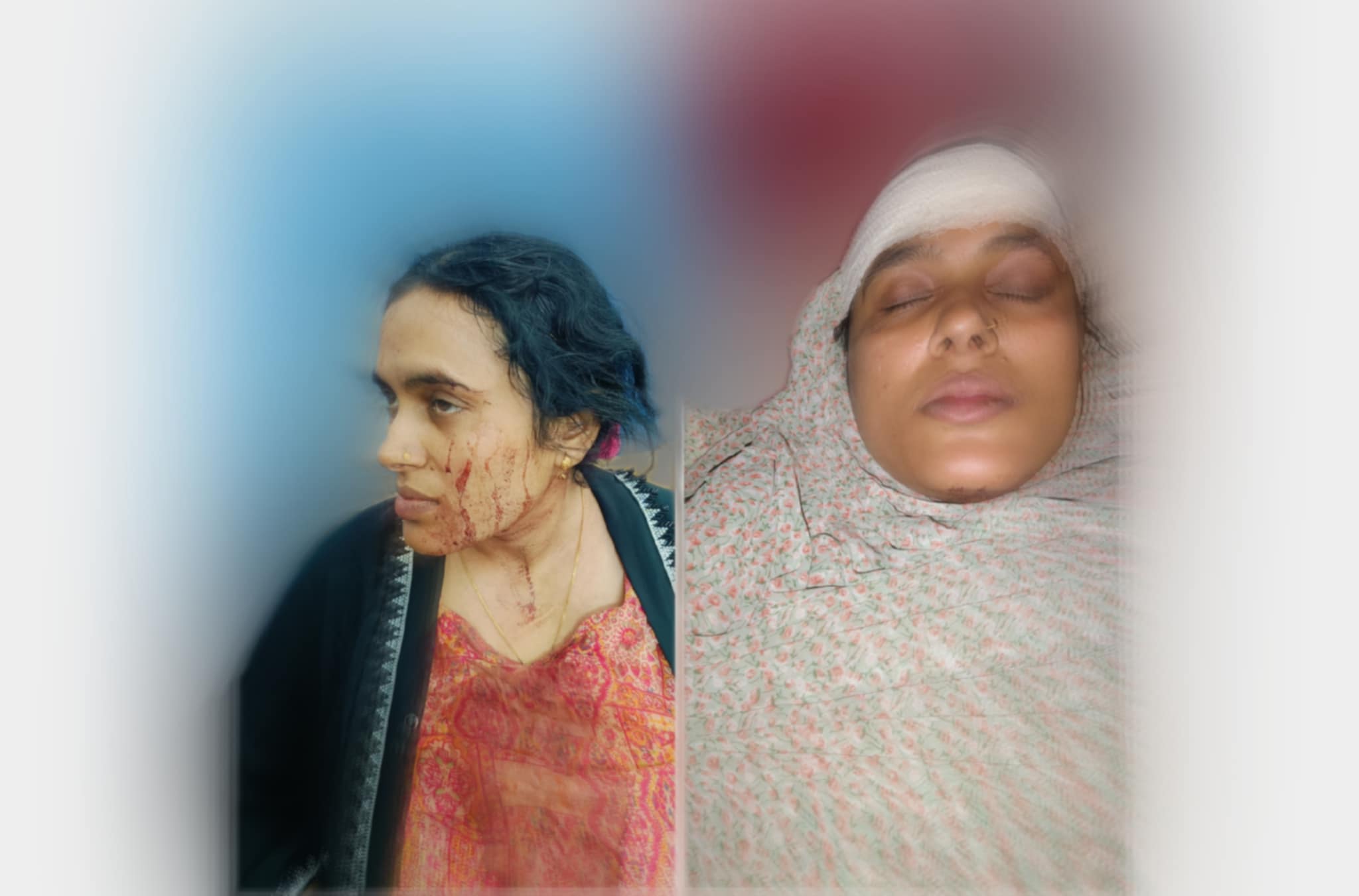 বাকেরগঞ্জের দুধলে জমি নিয়ে সংঘর্ষে গৃহবধূকে কুপিয়ে হত্যা চেষ্টার অভিযোগ