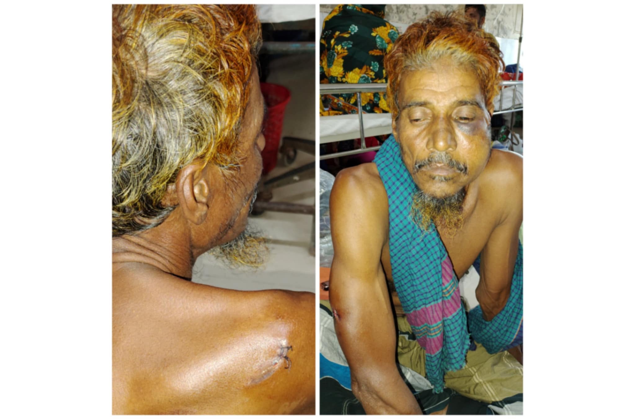 মেহেন্দিগঞ্জে শ্রমিক দল নেতাকে কুপিয়ে হত্যা চেষ্টার অভিযোগ