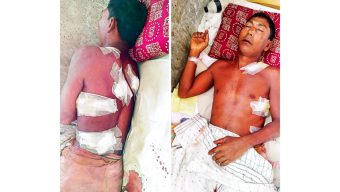বাকেরগঞ্জের চাঁদার দাবিতে দিনমজুরকে কুপিয়ে জখম