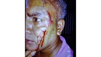 গৌরনদীতে তুচ্ছ ঘটনার জের, সংঘর্ষে আহত- ৩