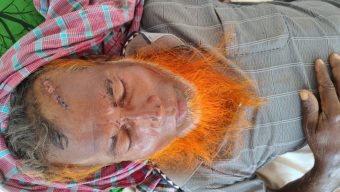 গলাচিপায় খাস জমি নিয়ে দ্বন্দ্ব-১০ জনকে কুপিয়ে পিটিয়ে জখম 