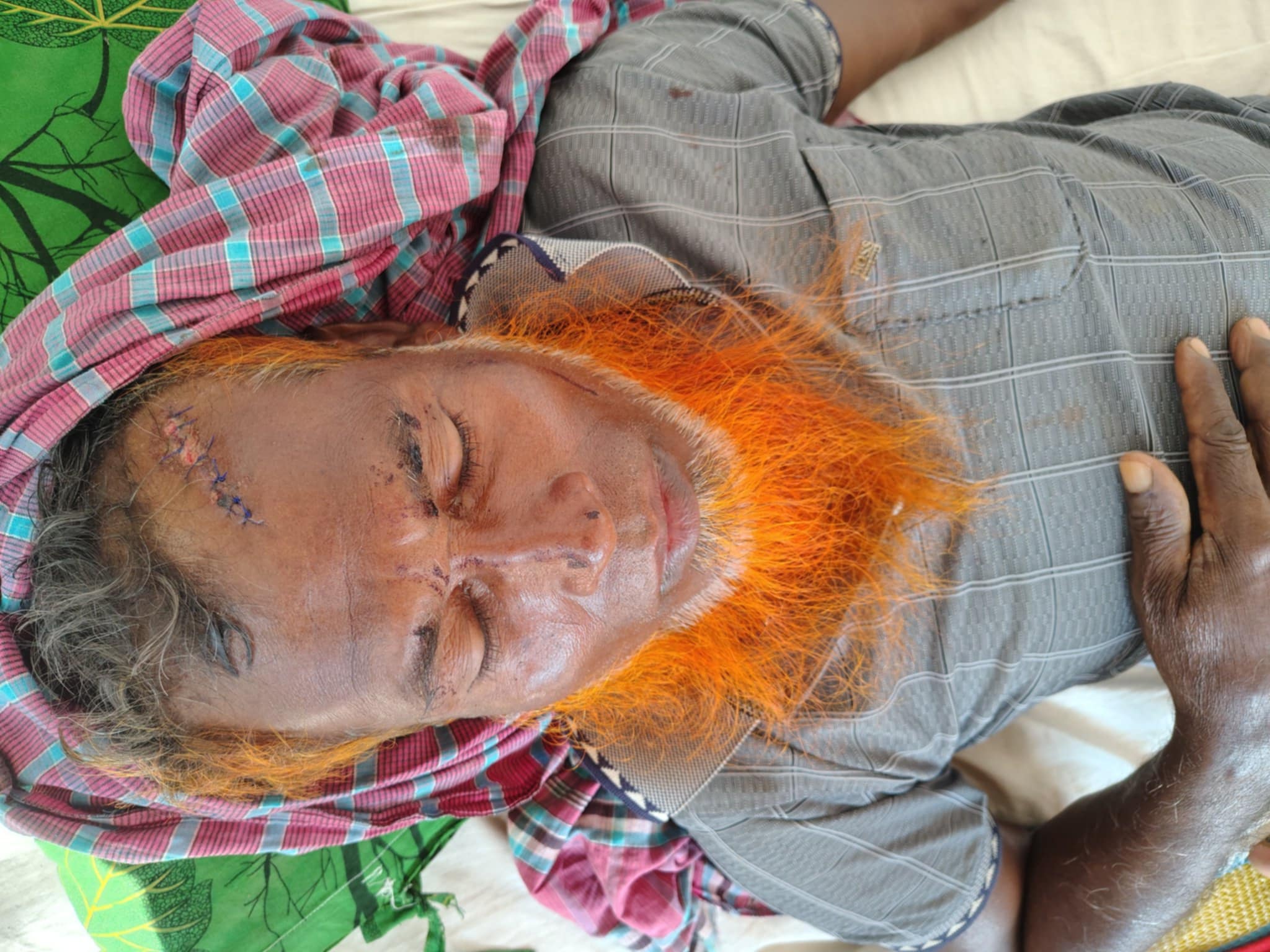 গলাচিপায় খাস জমি নিয়ে দ্বন্দ্ব-১০ জনকে কুপিয়ে পিটিয়ে জখম 