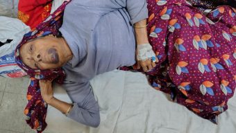 মঠবাড়িয়ায় ৮৫ বছরের বৃদ্ধাকে পিটিয়ে হাড় ভেঙ্গে দেয়ার অভিযোগ