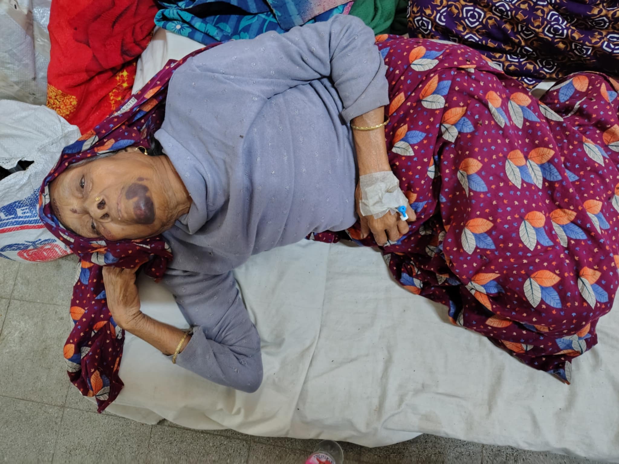 মঠবাড়িয়ায় ৮৫ বছরের বৃদ্ধাকে পিটিয়ে হাড় ভেঙ্গে দেয়ার অভিযোগ