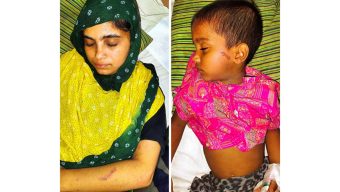 বাকেরগঞ্জে মা ও শিশু সন্তানকে লোহার গরম ছ্যাকা দিয়ে নির্যাতন ও হামলার অভিযোগ