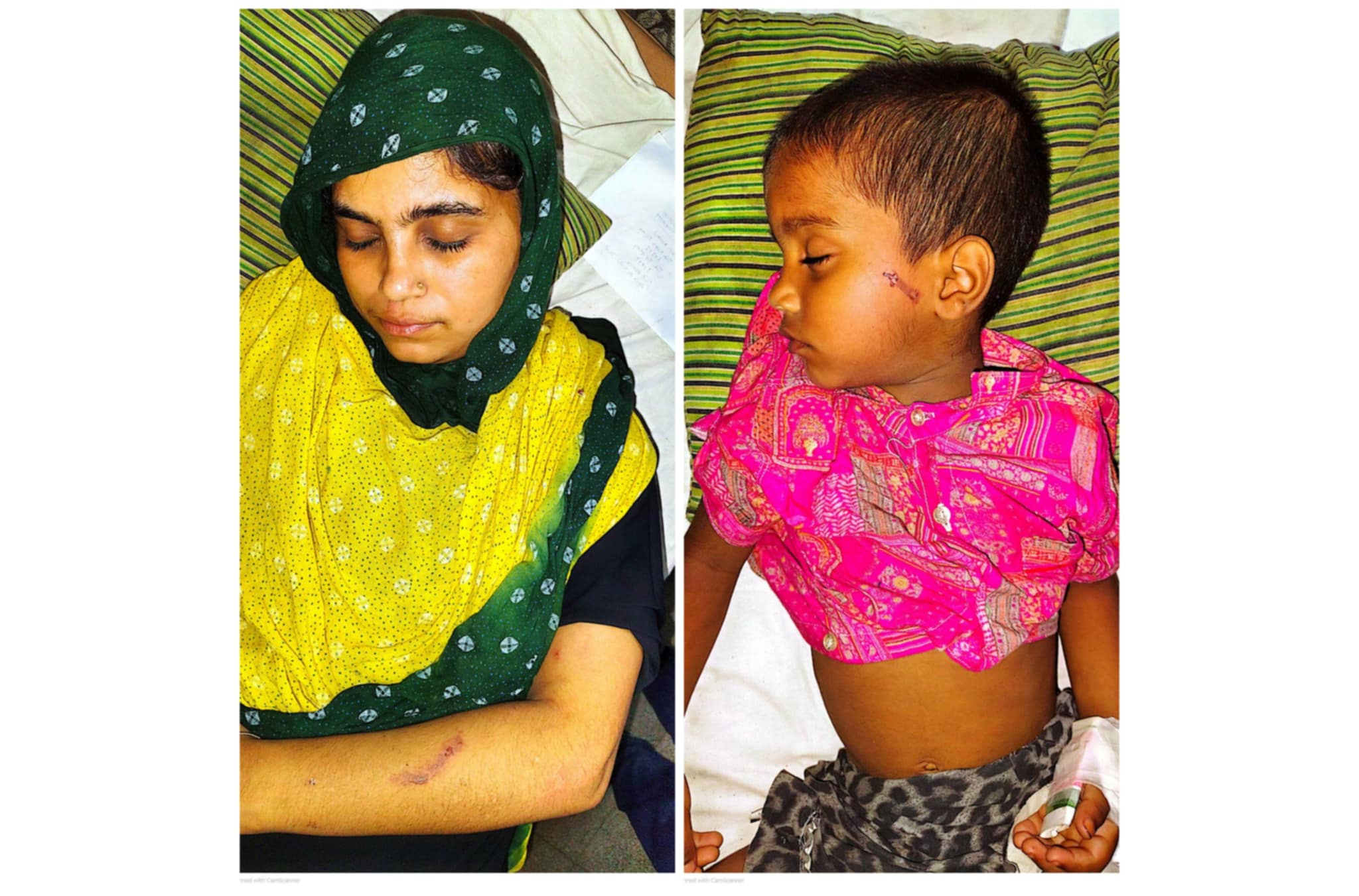 বাকেরগঞ্জে মা ও শিশু সন্তানকে লোহার গরম ছ্যাকা দিয়ে নির্যাতন ও হামলার অভিযোগ