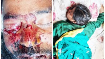 বাকেরগঞ্জে যৌতুকের দাবিতে নির্যাতন আহত ৩, মামলা দায়ের,