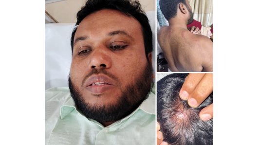 মির্জাগঞ্জে চাঁদা না দেয়াকে কেন্দ্র করে ঠিকাদারের উপর হামলার অভিযোগ