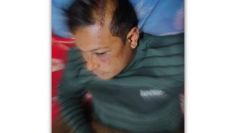 গৌরনদীতে সাবেক ছাত্রদল সভাপতি কে কুপিয়ে হত্যা চেষ্টার অভিযোগ