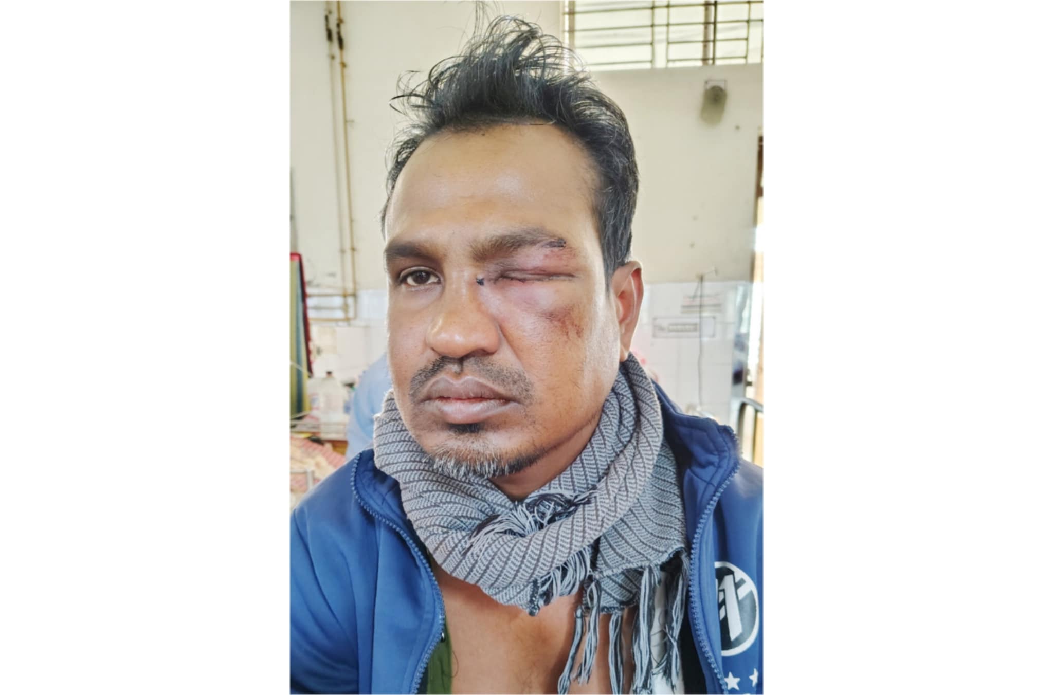 দশমিনায় অটোচালক কে হামলা চালিয়ে লাখ টাকা ছিনতাই