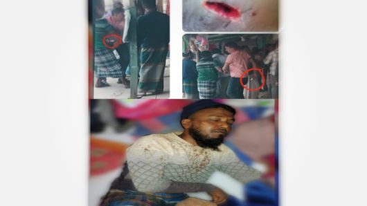 কলাপড়ায় স্বেচ্ছাসেবক দল নেতাকে কুপিয়ে হত্যা চেষ্টার রহস্যের জট উন্মোচন!