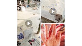 কাউনিয়ার বাটনায় জমি নিয়ে সংঘর্ষে নারীকে পিটিয়ে হাত ভেঙে দেয়ার অভিযোগ