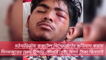 মঠবাড়িয়ায় ককটেল বিস্ফোরণের প্রতিবাদ করায় দিনমজুরের চোখ উপড়ে ফেলার চেষ্টা, নগদ টাকা ছিনতাই