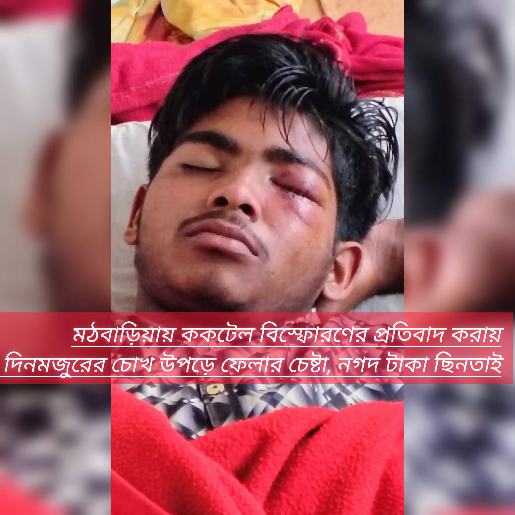 মঠবাড়িয়ায় ককটেল বিস্ফোরণের প্রতিবাদ করায় দিনমজুরের চোখ উপড়ে ফেলার চেষ্টা, নগদ টাকা ছিনতাই