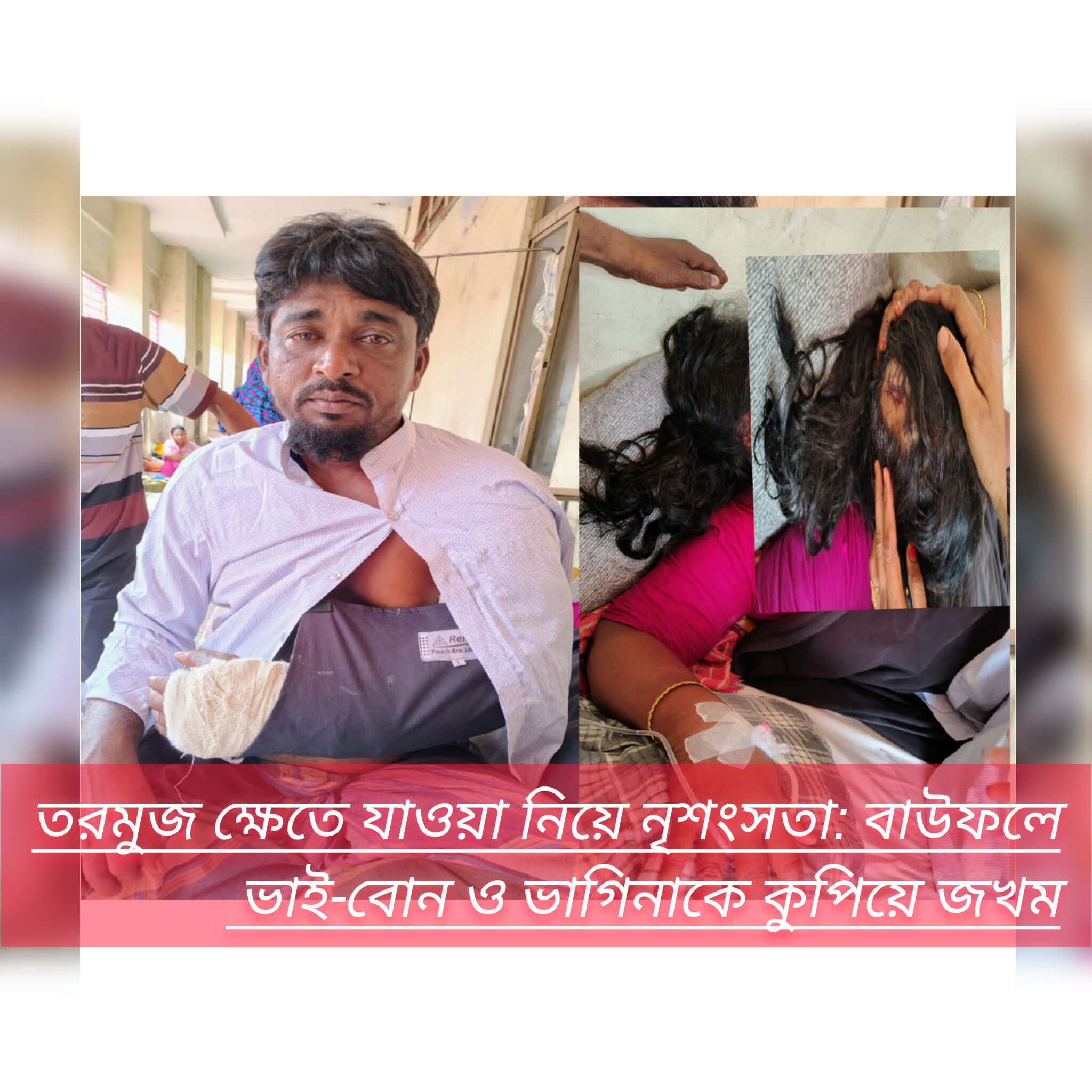 তরমুজ ক্ষেতে যাওয়া নিয়ে নৃশংসতা: বাউফলে ভাই-বোন ও ভাগিনাকে কুপিয়ে জখম