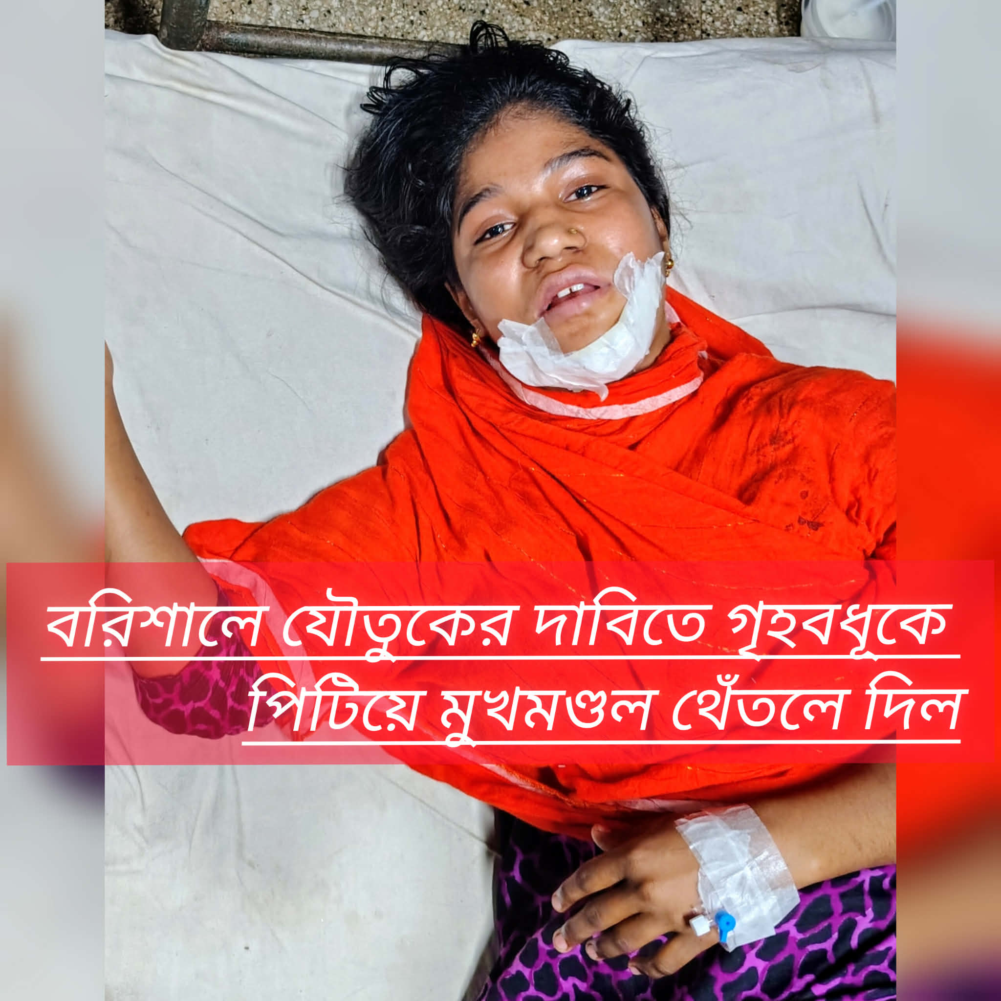 বরিশালে যৌতুকের দাবিতে গৃহবধূকে পিটিয়ে মুখমণ্ডল থেঁতলে দিল পাষণ্ড স্বামী