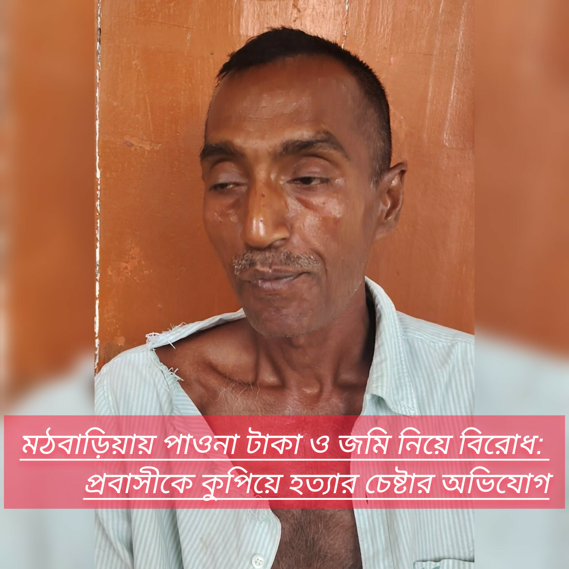 মঠবাড়িয়ায় পাওনা টাকা ও জমি নিয়ে বিরোধ: প্রবাসীকে কুপিয়ে হত্যার চেষ্টার অভিযোগ