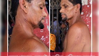 কলাপাড়ায় মোবাইল চুরির প্রতিবাদ করায় ব্যবসায়ীকে কুপিয়ে জখম, নগদ অর্থ ছিনতাই