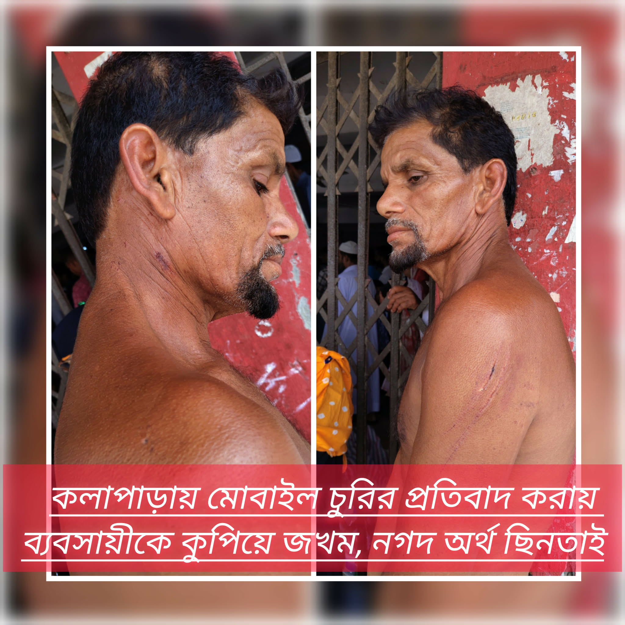 কলাপাড়ায় মোবাইল চুরির প্রতিবাদ করায় ব্যবসায়ীকে কুপিয়ে জখম, নগদ অর্থ ছিনতাই