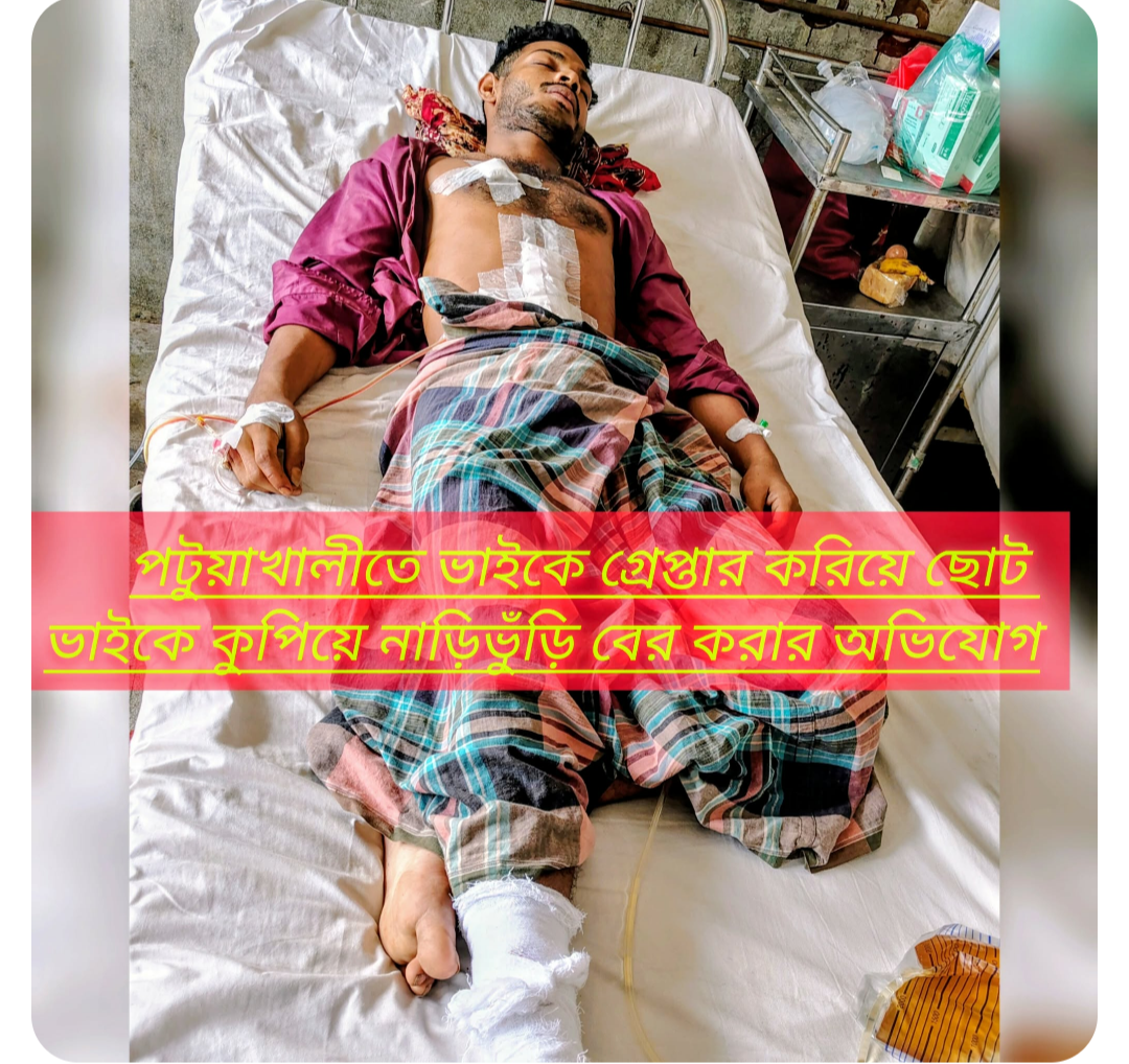 পটুয়াখালীতে ভাইকে গ্রেপ্তার করিয়ে ছোট ভাইকে কুপিয়ে নাড়িভুঁড়ি বের করার অভিযোগ