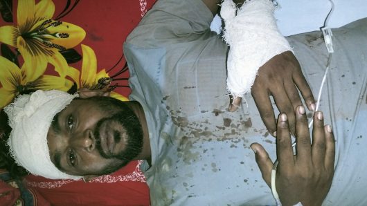 কলাপাড়ায় পূর্ব শত্রুতার জের ধরে ব্যবসায়ীকে কুপিয়ে জখম