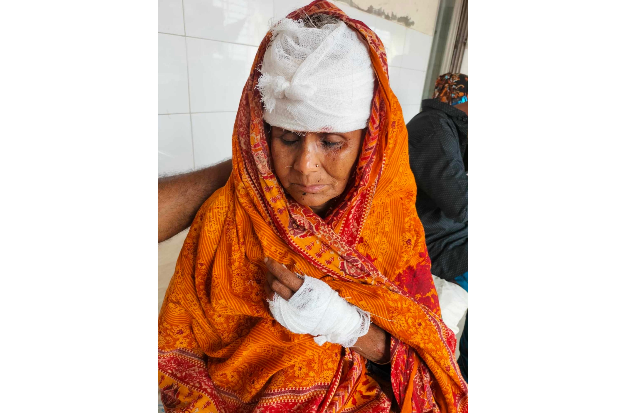 কাজিরহাট থানা এলাকায় পূর্ব শত্রুতার জের ধরে এক নারীকে কুপিয়ে জখম