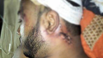 কাঠালিয়া ছাত্রদল নেতাকে কুপিয়ে হত্যা চেষ্টার অভিযোগ 