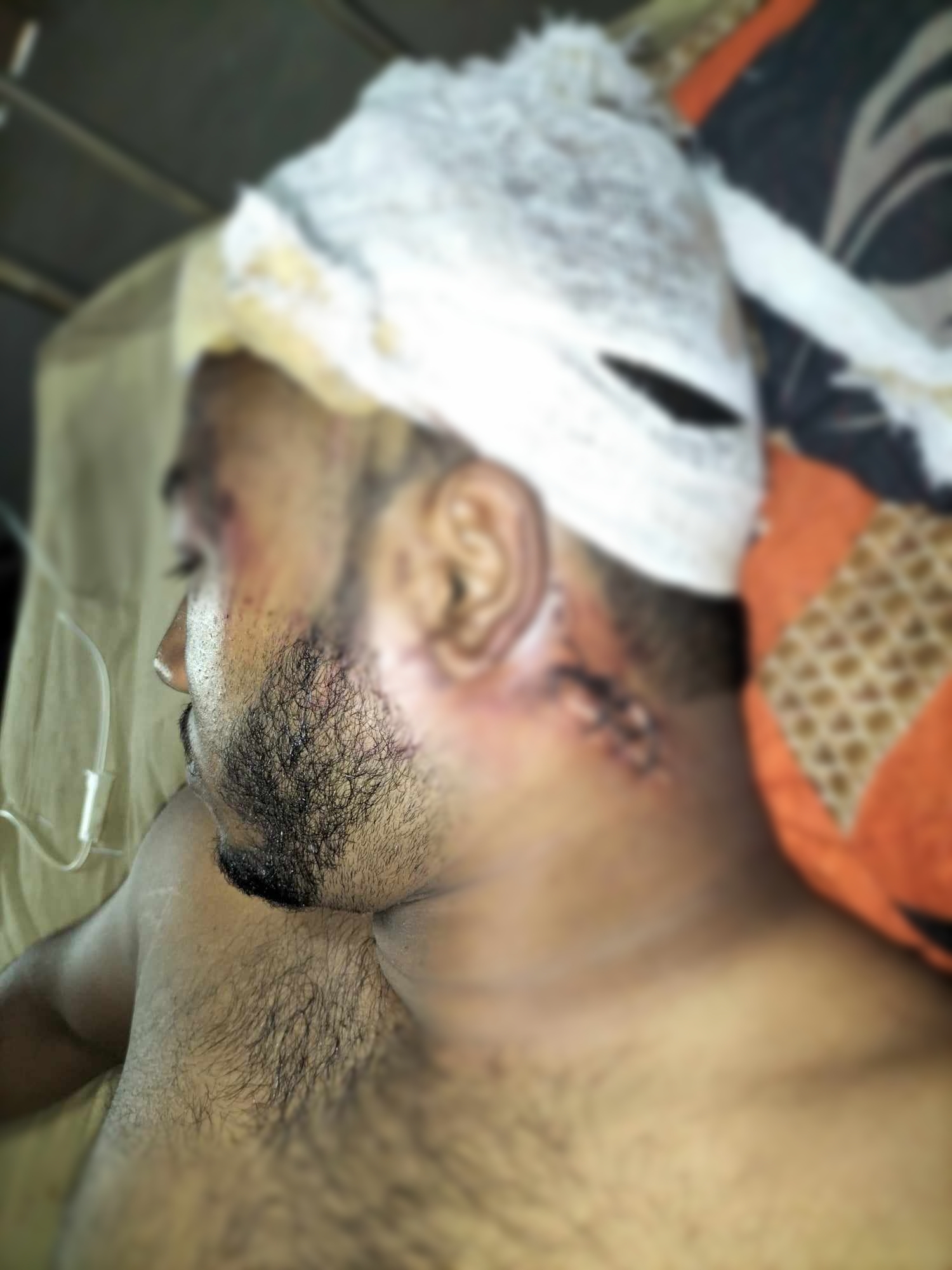 কাঠালিয়া ছাত্রদল নেতাকে কুপিয়ে হত্যা চেষ্টার অভিযোগ 