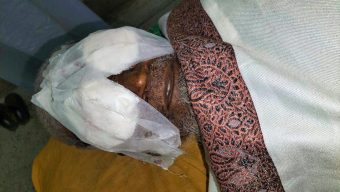 মির্জাগঞ্জে জমি নিয়ে দ্বন্দ্বে বৃদ্ধের দুটি চোখ নষ্ট করে দেয়ার অভিযোগ