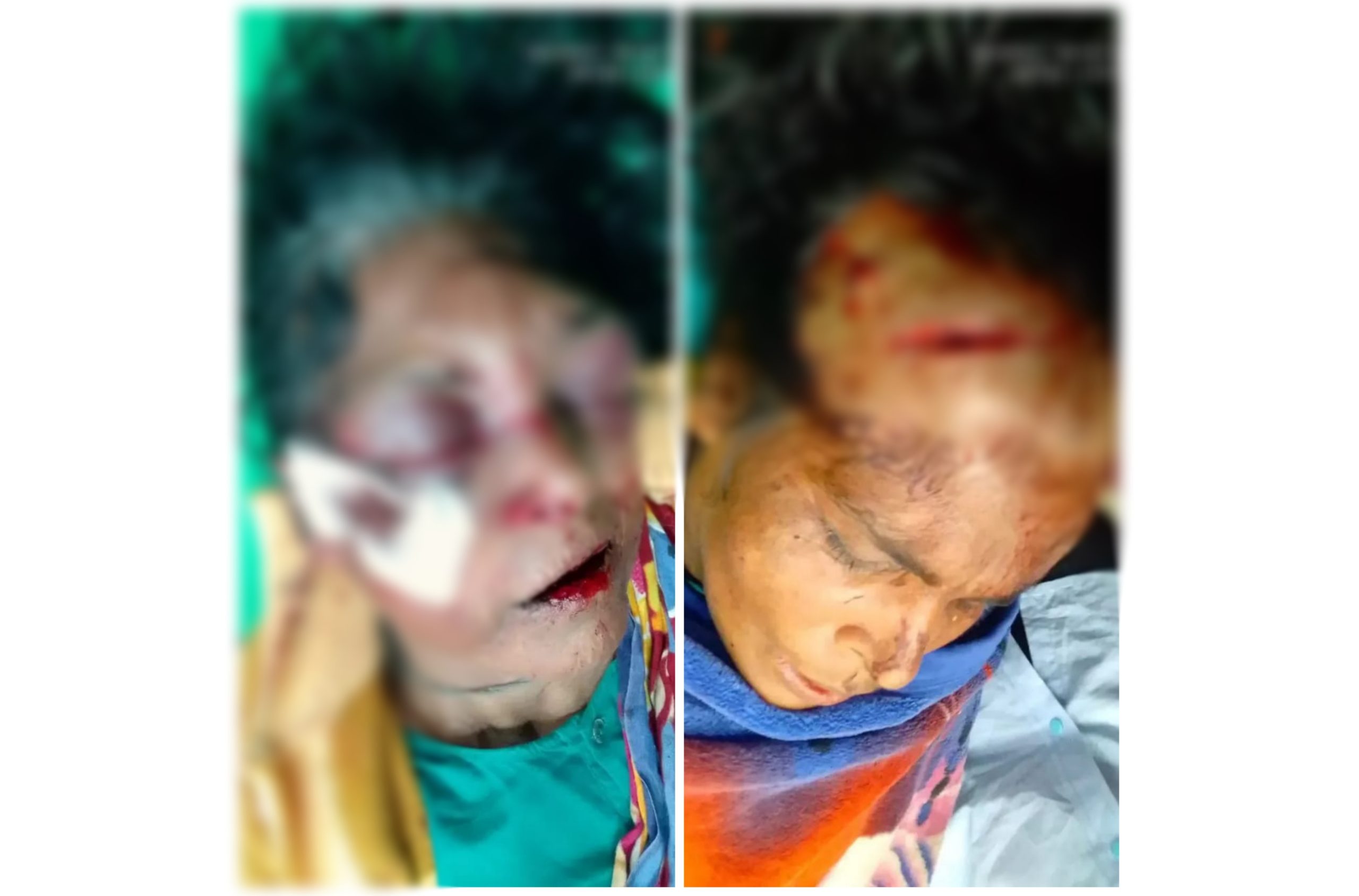 পটুয়াখালীতে প্রবাসীর মা-বোন ও ভাগ্নিকে কুপিয়ে জখমের অভিযোগ 