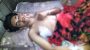 কলাপাড়ায় কিশোর গ্যাং সন্ত্রাসীদের হামলায় রক্তাক্ত শিক্ষার্থী রিফাত শেবাচিমে