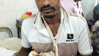 দৌলতখানে বিএনপি নেতাকে কুপিয়ে পিটিয়ে হাত ভেঙ্গে দেয়ার অভিযোগ