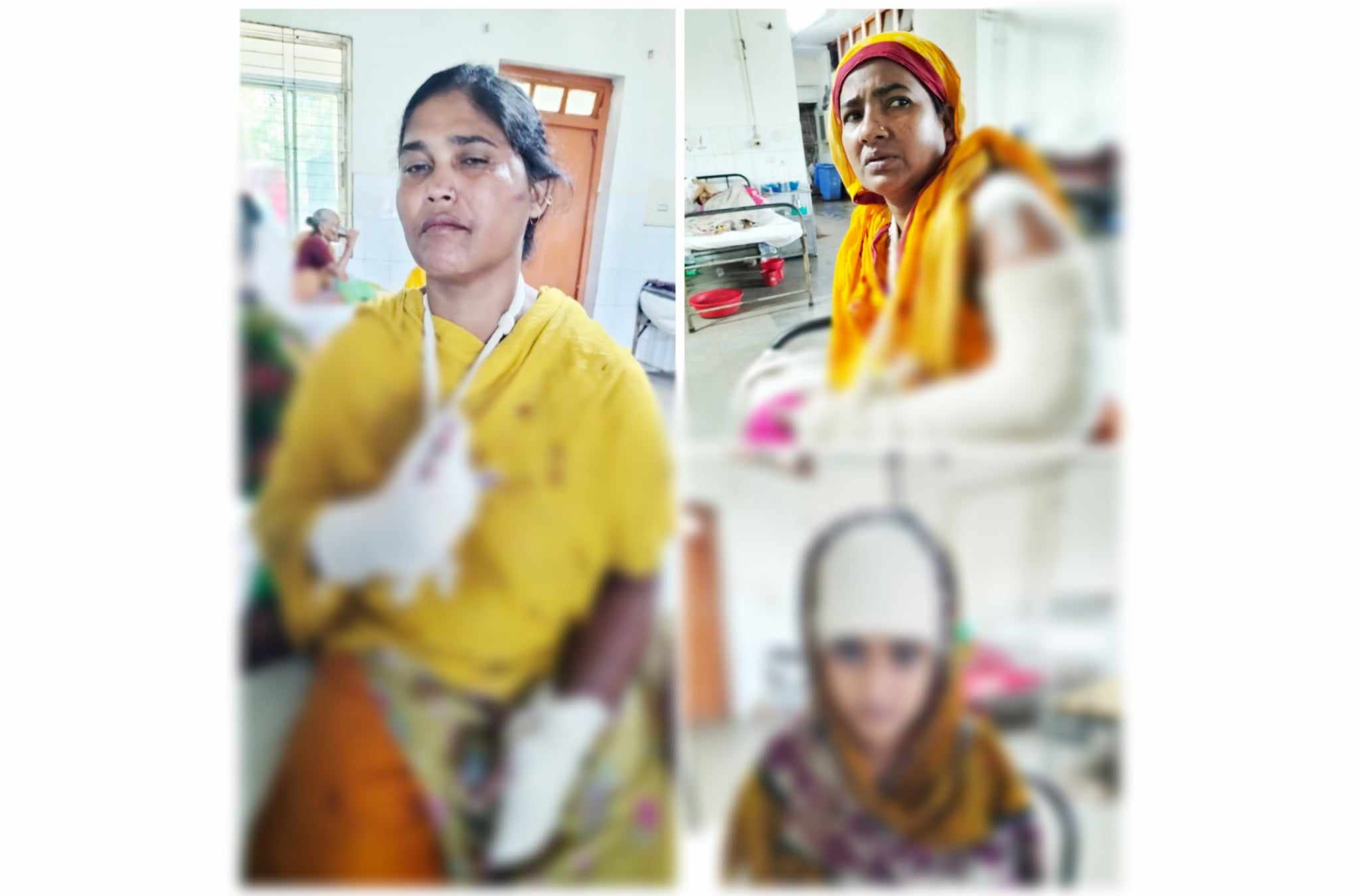 কুপ্রস্তাবের প্রতিবাদে ভাবি, ভাতিজি ও বোনকে কুপিয়ে পিটিয়ে হাত ভেঙ্গে দেয়ার অভিযোগ