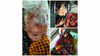 পাথরঘাটায় বসতঘরে আগুন, বৃদ্ধাসহ আহত- ৫