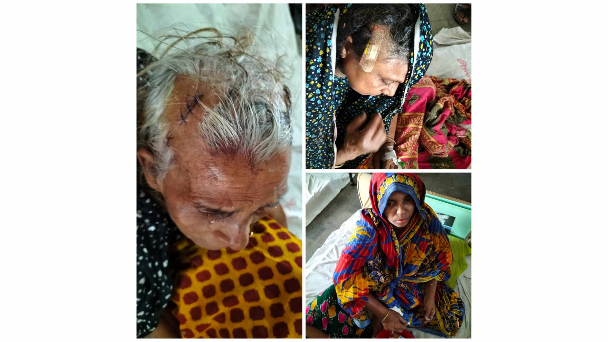 পাথরঘাটায় বসতঘরে আগুন, বৃদ্ধাসহ আহত- ৫
