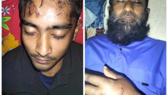ভান্ডারিয়ায় জমি দখল করতে বাবা ও ছেলেকে কুপিয়ে হত্যার চেষ্টা!
