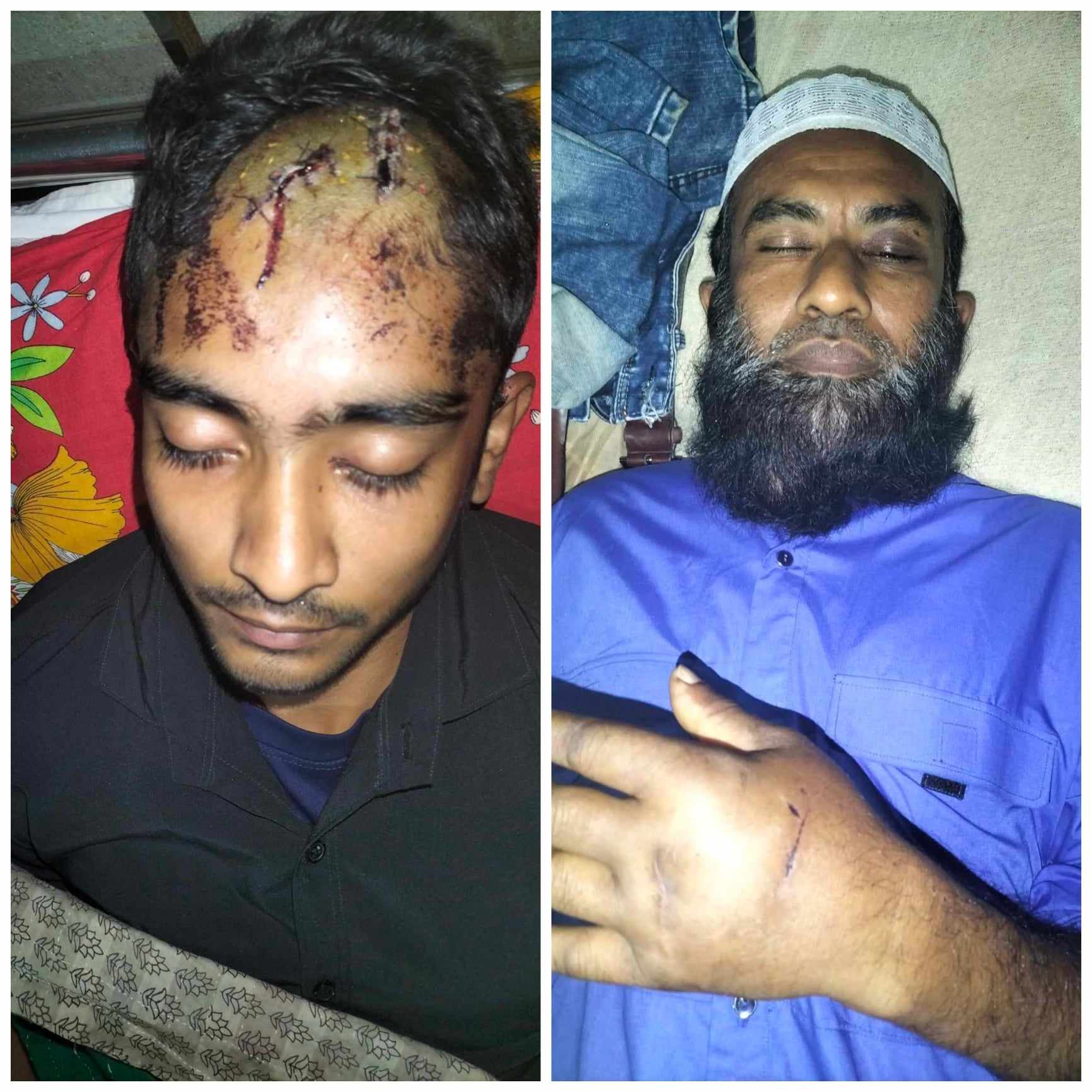 ভান্ডারিয়ায় জমি দখল করতে বাবা ও ছেলেকে কুপিয়ে হত্যার চেষ্টা!