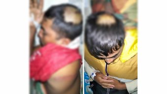 কলাপাড়ায় পূর্ব শত্রুতার জেরে ২ ভাইকে কুপিয়ে হত্যার চেষ্টা!