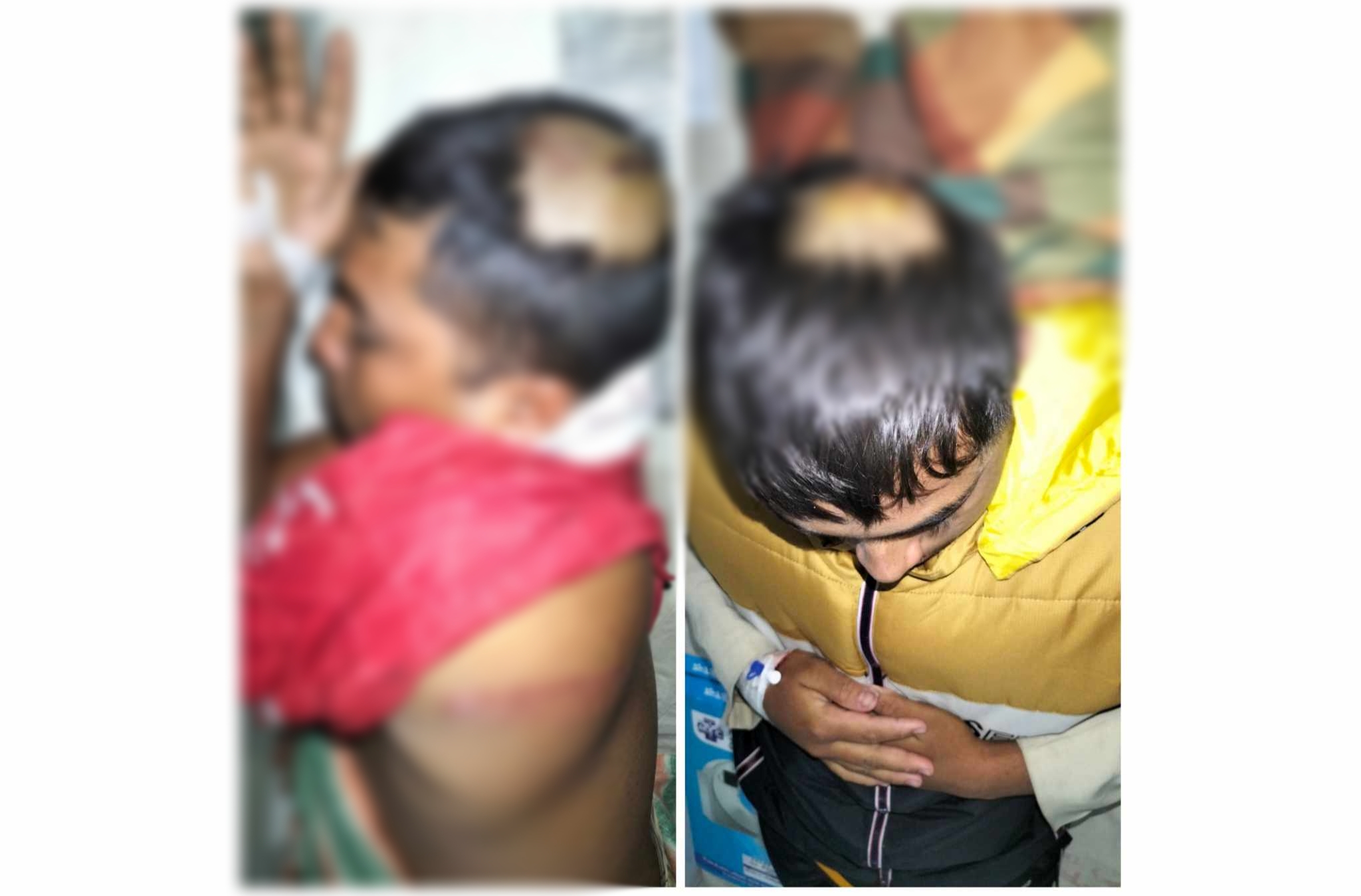 কলাপাড়ায় পূর্ব শত্রুতার জেরে ২ ভাইকে কুপিয়ে হত্যার চেষ্টা!